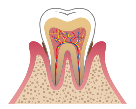 軽度歯周病