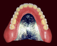 金属床（コバルト）義歯